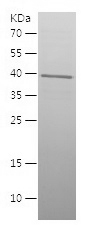 Recombinant Human ACTN4/人源ACTN