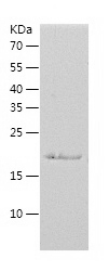 Recombinant Human EIF3J/人源EIF3