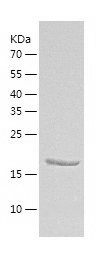 Recombinant Human CDKN1B/人源CDK
