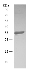 Recombinant Human RNASET2/人源RN