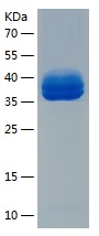 Recombinant Human DLK-1/人源DLK-