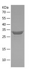 Recombinant Human HLA-C/人源HLA-