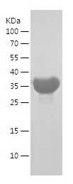 Recombinant Human TOMM34/人源TOM