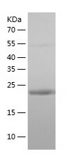 Recombinant Human LIN7B/人源LIN7