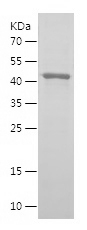 Recombinant Human OSBP/人源OSBP蛋