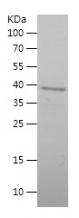 Recombinant Human UCP1/人源UCP1蛋