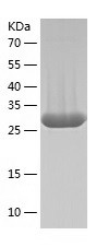 Recombinant Human SNAI1/人源SNAI