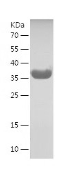 Recombinant Human LASP1/人源LASP