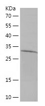Recombinant Human CXCR7/人源CXCR