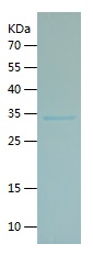 Recombinant Human CHRNA7/人源CHR
