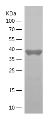 Recombinant Human PPRC1/人源PPRC