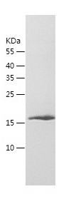 Recombinant Human MYL12B/人源MYL