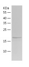 Recombinant Human UPK3A/人源UPK3