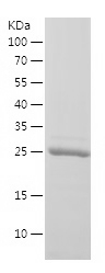 Recombinant Human GSTP1/人源GSTP