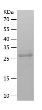 Recombinant Human MAD2L1BP/人源M
