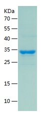 Recombinant Human ABCC1/人源ABCC