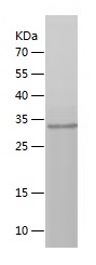 Recombinant Human VSNL1/人源VSNL
