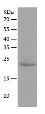 Recombinant Human PCMTD1/人源PCM