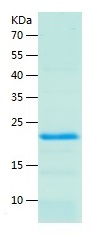Recombinant Human GJA1/人源GJA1蛋