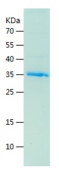 Recombinant Human FBLN1/人源FBLN