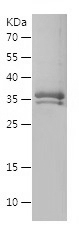 Recombinant Human AGTR1/人源AGTR