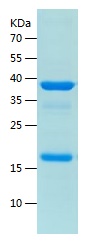 Recombinant Human KHDC1L/人源KHD