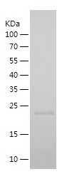 Recombinant Human CCNA1/人源CCNA