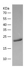 Recombinant Human ANAPC2/人源ANA