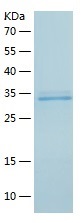 Recombinant Human MMP-3/人源MMP-