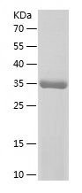 Recombinant Human NDUFS6/人源NDU