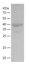 Recombinant Human COL9A1/人源COL