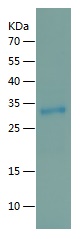 Recombinant Human RAB3GAP1/人源R