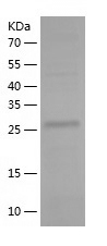 Recombinant Human ZNF439/人源ZNF