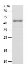 Recombinant Human ARL6/人源ARL6蛋