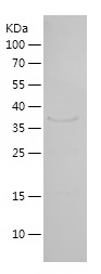 Recombinant Human HEY1/人源HEY1蛋