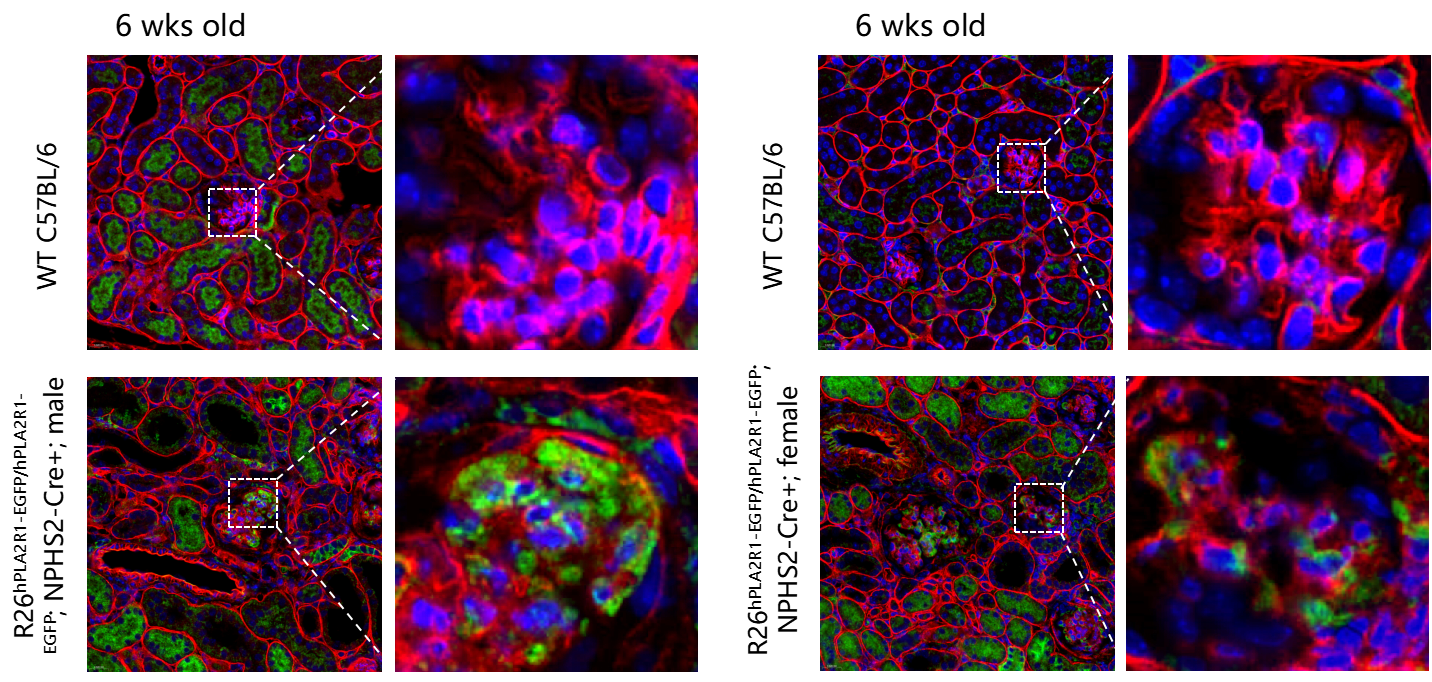 瞄准PLA2R1！无需干预，南模生物自发膜性肾病模型