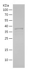Recombinant Human MEF2C/人源MEF2