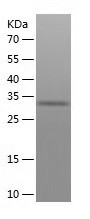 Recombinant Human OR1A1/人源OR1A