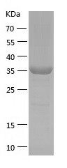 Recombinant Human Dnmt3L/人源Dnm