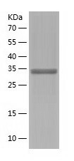 Recombinant Human ACY3/人源ACY3蛋