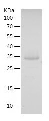 Recombinant Human FBLIM1/人源FBL