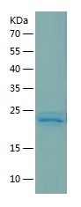 Recombinant Human CST7/人源CST7蛋