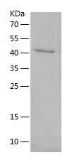 Recombinant Human SESN1/人源SESN