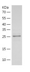 Recombinant Human LAMA5/人源LAMA