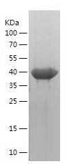 Recombinant Human MAGEB18/人源MA