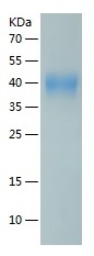 Recombinant Human ESAM/人源ESAM蛋
