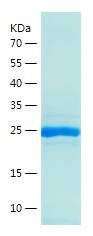 Recombinant Human AIPL1/人源AIPL