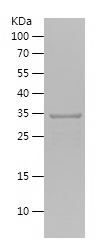 Recombinant Human NOP58/人源NOP5