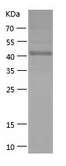 Recombinant Human ACP6/人源ACP6蛋