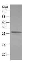 Recombinant Human ZNF562/人源ZNF